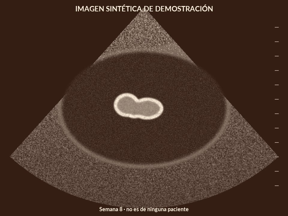 Semana 8